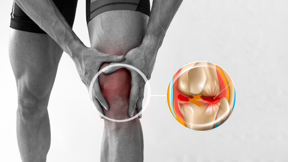 meniskus ameliyati