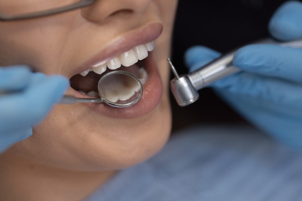 dental implant kadıköy